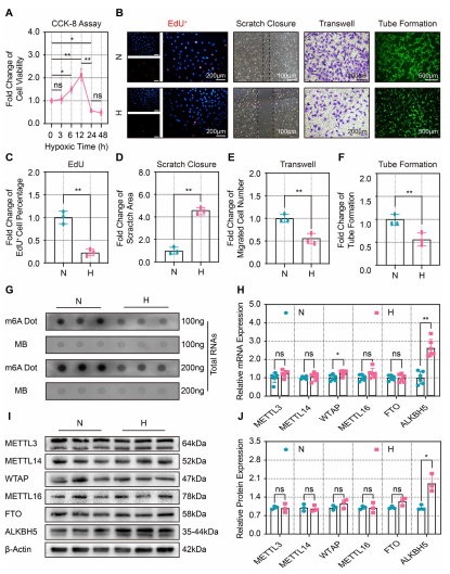 1ȱpѪCMECs{ALKBH5ı_