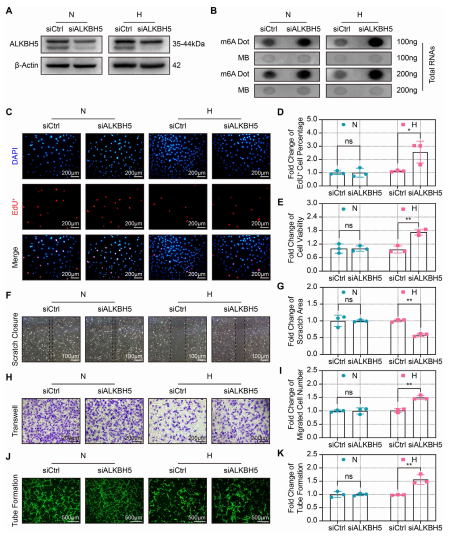 3ALKBH5{ɜppȱTCMECsϵK