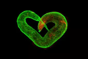 線蟲顯微注射如何操作?超詳細實驗步驟快來碼住