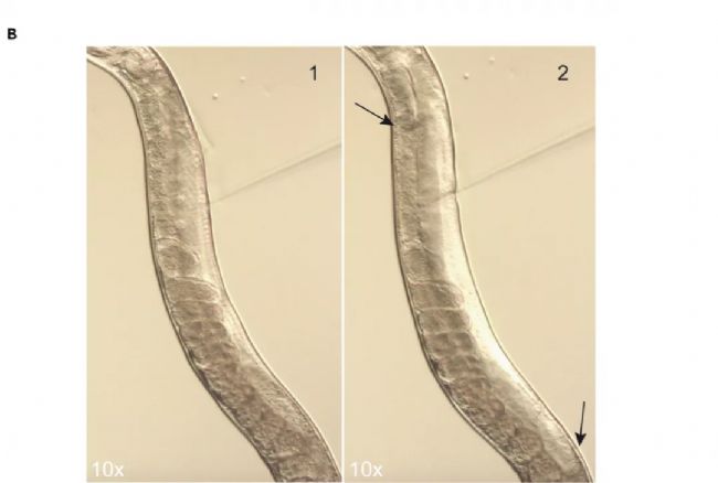 線蟲顯微注射如何操作?超詳細實驗步驟快來碼住