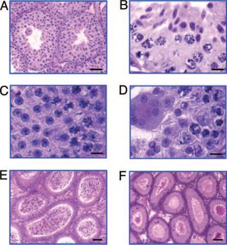 Ybx2基因敲除小鼠