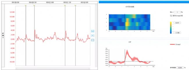 光纖記錄詳解,一文帶你詳細了解光纖記錄實驗
