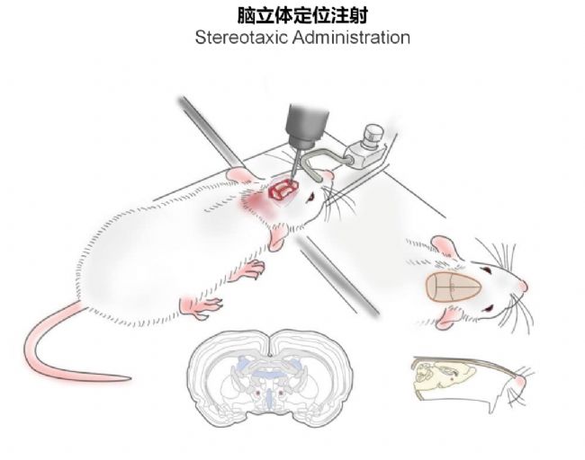 神經(jīng)疾病CRO服務(wù)