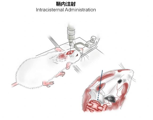 神經(jīng)疾病CRO服務(wù)
