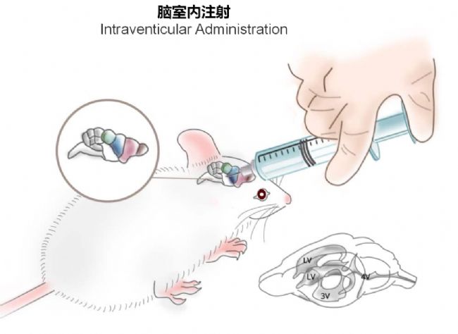 神經(jīng)疾病CRO服務(wù)