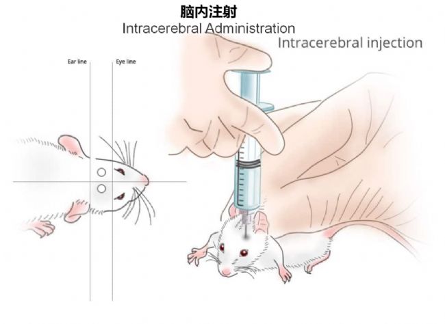 神經(jīng)疾病CRO服務(wù)