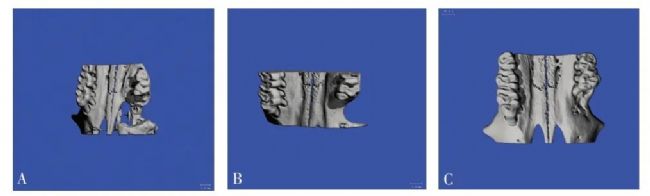 顯微 CT 觀察新骨形成