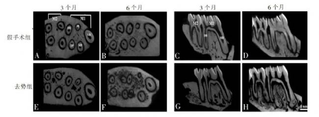 牙齒的顯微 CT 成像