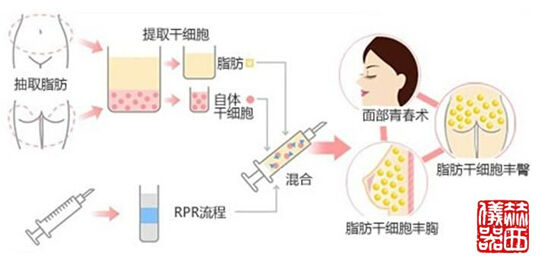 赫西儀器成功打造PRP美容離心機