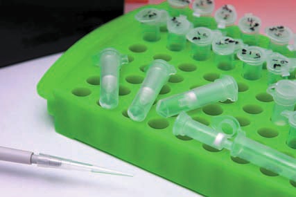 Chromatrap® Pro-A һNʽȾɫ|߳ (ChIP) ygɹxsƬеĸ|Ⱦɫ|˴ΑעسԭʼӌmĤg|еı^zӛY Chromatrap® gĽMƬ 1 fгɹx˴ı^zӛ IgG ԻλcxԵ˻ӻĿ 