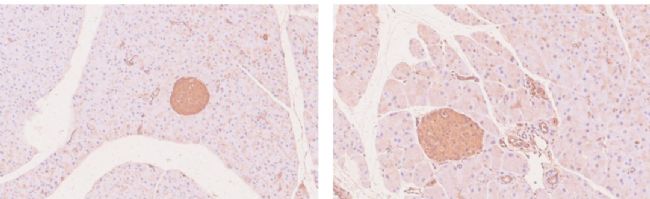 hGLP1R全人源化小鼠模型
