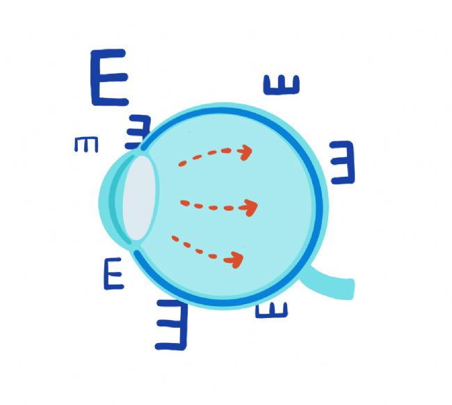 “致盲眼病”青光眼的臨床前研究進展