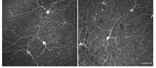 【W(wǎng)ebniar】眼中的秘密!正常老齡化和阿爾茨海默癥模型小鼠的視覺功能