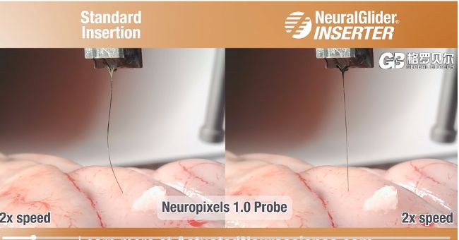 格羅貝爾引入超聲黑科技:助力電極精準(zhǔn)植入與長效穩(wěn)定
