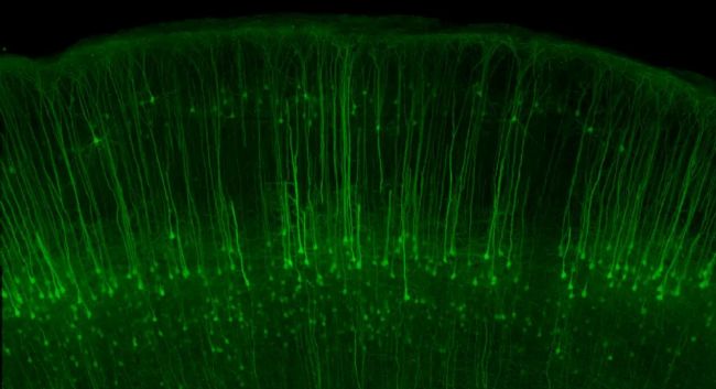 Evident is setting a new standard in life science imaging with its launch of the new FLUOVIEW™ FV5000 confocal and multiphoton laser scanning microscope